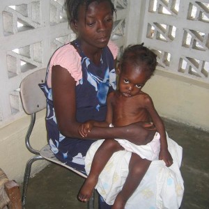 Waiting to receive treatment for malnutrition